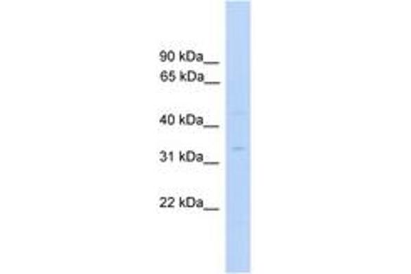 MTFMT antibody  (C-Term)