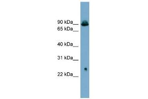 WB Suggested Anti-SLC6A5 Antibody Titration:  0. (SLC6A5 antibody  (Middle Region))