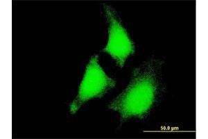 Immunofluorescence of monoclonal antibody to MAP2K5 on HeLa cell. (MAP2K5 antibody  (AA 1-120))