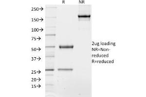 SDS-PAGE Analysis of Purified TCF4 Mouse Monoclonal Antibody (TCF4/1705). (TCF4 antibody  (AA 365-671))