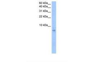 Image no. 1 for anti-Septin 6 (SEPT6) (AA 51-100) antibody (ABIN6738227) (Septin 6 antibody  (AA 51-100))