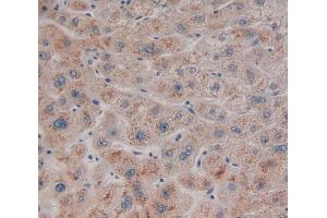 Used in DAB staining on fromalin fixed paraffin- embedded Kidney tissue (RSU1 antibody  (AA 2-277))