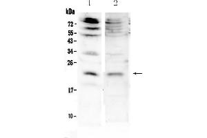 Western blot analysis of KGF using anti-KGF antibody . (FGF7 antibody  (AA 32-194))