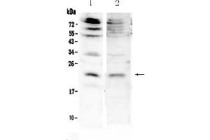 Western blot analysis of KGF using anti-KGF antibody . (FGF7 antibody  (AA 32-194))