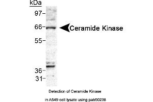 Image no. 1 for anti-Ceramide Kinase (CERK) (AA 50-150) antibody (ABIN363547) (CERK antibody  (AA 50-150))