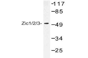 Western blot (WB) analysis of Zic1/2/3 antibody in extracts from Jurkat cells. (ZIC1 antibody)