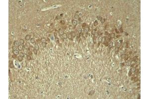 Immunohistochemistry (IHC) image for anti-Microtubule-Associated Protein tau (MAPT) (pThr181) antibody (ABIN7138784)