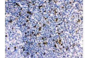 IHC testing of FFPE human tonsil with APOBEC3G antibody at 1ug/ml. (APOBEC3G antibody)