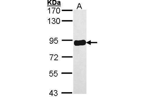 PRKCSH antibody