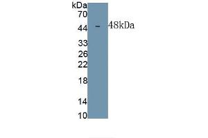 Detection of Recombinant DPEP1, Human using Monoclonal Antibody to Dipeptidase 1, Renal (DPEP1) (DPEP1 antibody  (AA 17-411))