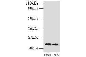 Western blot All lanes: TAGLN antibody at 2 μg/mL Lane 1: EC109 whole cell lysate Lane 2: 293T whole cell lysate Secondary Goat polyclonal to rabbit IgG at 1/15000 dilution Predicted band size: 23 kDa Observed band size: 23 kDa