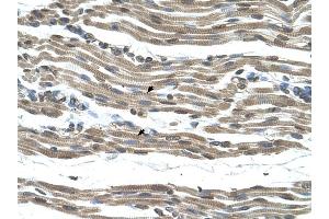 COX15 antibody was used for immunohistochemistry at a concentration of 4-8 ug/ml to stain Skeletal muscle cells (arrows) in Human Muscle.