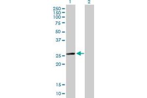 Western Blot analysis of MYL6B expression in transfected 293T cell line by MYL6B MaxPab polyclonal antibody. (MYL6B antibody  (AA 1-208))