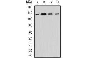 Western blot analysis of Myosin Ic expression in HT29 (A), SKOV3 (B), mouse lung (C), rat heart (D) whole cell lysates. (Myosin IC antibody)