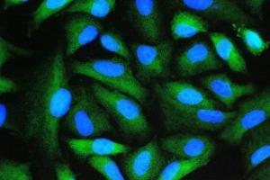 anti-Peptidylprolyl Isomerase A (Cyclophilin A) (PPIA) (AA 116-165) antibody