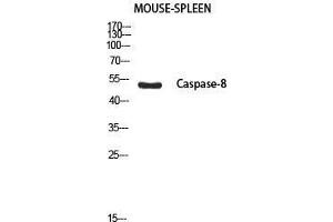 Western Blot (WB) analysis of Mouse Spleen using Cleaved-Caspase-8 p18 (S217) antibody. (Caspase-8 p18 antibody  (cleaved, Ser217))