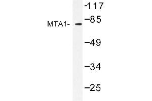 Image no. 1 for anti-Metastasis Associated 1 (MTA1) antibody (ABIN272222) (MTA1 antibody)