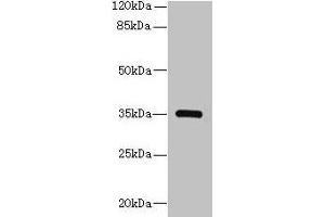 Western blot All lanes: STX19 antibody at 2 μg/mL + K562 whole cell lysate Secondary Goat polyclonal to rabbit IgG at 1/10000 dilution Predicted band size: 35 kDa Observed band size: 35 kDa (Syntaxin 19 antibody  (AA 1-140))