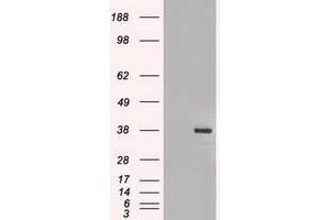 Image no. 3 for anti-Fibroblast Growth Factor 2 (Basic) (FGF2) (AA 10-155) antibody (ABIN1490786) (FGF2 antibody  (AA 10-155))