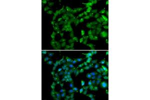 Immunofluorescence analysis of U20S cell using PRKAB2 antibody. (PRKAB2 antibody)