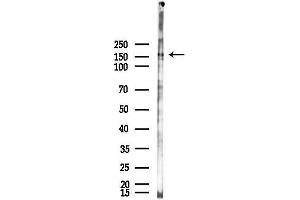 Western blot analysis of lysates from F10-LUC cells(starvation,24h treatment), using USP47 Antibody at 1/1000 dilution.