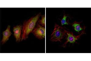 Immunofluorescence analysis of Hela (left) and HepG2 (right) cells using EphB2 mouse mAb (green). (EPH Receptor B2 antibody  (AA 17-200))