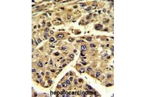 Immunohistochemistry (IHC) image for anti-Eukaryotic Translation Initiation Factor 3 Subunit H (EIF3H) antibody (ABIN3002723) (EIF3H antibody)