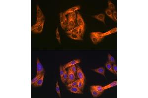 Immunofluorescence analysis of U-2 OS cells using T Rabbit mAb (ABIN1680832, ABIN7101518, ABIN7101519 and ABIN7101520) at dilution of 1:100 (40x lens). (TAB1 antibody)