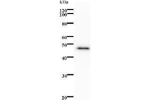 Western Blotting (WB) image for anti-B Double Prime 1, Subunit of RNA Polymerase III Transcription Initiation Factor IIIB (BDP1) antibody (ABIN931198) (BDP1 antibody)