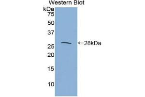 Western blot analysis of the recombinant protein. (IL27 Receptor alpha antibody  (AA 123-343))