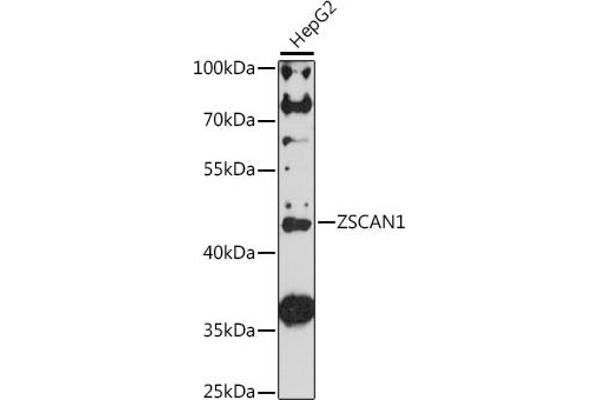 ZSCAN1 Antikörper  (AA 300-400)