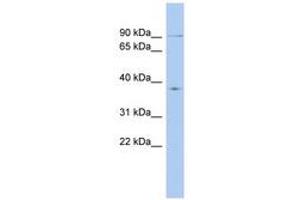 Image no. 1 for anti-Kinesin Family Member 2B (KIF2B) (AA 215-264) antibody (ABIN6742418) (KIF2B antibody  (AA 215-264))