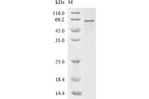 GTPase Activating Protein (SH3 Domain) Binding Protein 1 (G3BP1) (AA 1-465), (full length) protein (His tag)