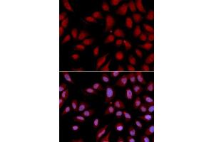 Immunofluorescence (IF) image for anti-Discs, Large (Drosophila) Homolog-Associated Protein 5 (DLGAP5) (AA 547-846) antibody (ABIN3023190)