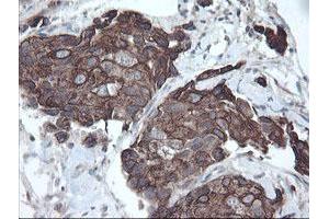 Image no. 2 for anti-Diphthamide Biosynthesis Protein 2 (DPH2) antibody (ABIN1497892) (DPH2 antibody)
