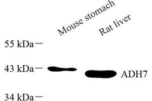 Western blot analysis of ADH7 (ABIN7072995) at dilution of 1: 500 (ADH7 antibody)