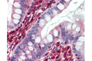 LDHB antibody was used for immunohistochemistry at a concentration of 4-8 ug/ml. (LDHB antibody  (C-Term))