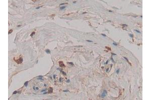 Immunohistochemistry (IHC) image for anti-Cathepsin D (CTSD) (AA 169-408) antibody (ABIN1858545)