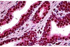 Human Prostate: Formalin-Fixed, Paraffin-Embedded (FFPE) (MEF2A antibody  (AA 71-170))