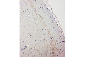 Anti-GABA A Receptor alpha 1 antibody, IHC(P) IHC(P): Rat Brain Tissue (GABRA1 antibody  (C-Term))