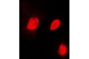 Immunofluorescent analysis of EID1 staining in HeLa cells. (EID1 antibody)