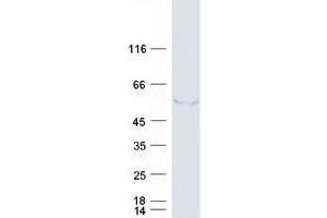 Validation with Western Blot (TRIM39 Protein (Transcript Variant 2) (Myc-DYKDDDDK Tag))