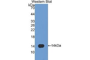 Detection of Recombinant CAV1, Rat using Polyclonal Antibody to Caveolin 1 (CAV1) (Caveolin-1 antibody  (AA 2-105))