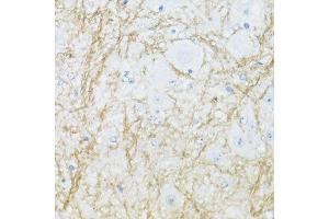Immunohistochemistry of paraffin-embedded mouse spinal cord using CNP antibody. (Cnpase antibody  (AA 152-421))