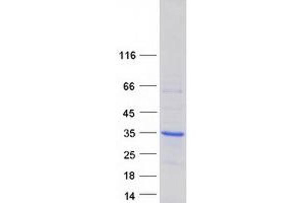 SHOX Protein (Transcript Variant 1) (Myc-DYKDDDDK Tag)