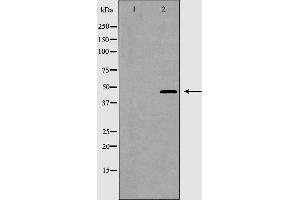 Western blot analysis of CRFR2 expression in K562 cells. (CRHR2 antibody  (Internal Region))