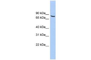 ACCN4 antibody used at 1 ug/ml to detect target protein. (ACCN4 antibody  (Middle Region))
