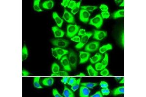 Immunofluorescence analysis of MCF-7 cells using RPS3A Polyclonal Antibody (RPS3A antibody)