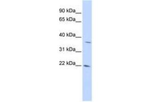 Image no. 1 for anti-DNA-Damage-Inducible Transcript 4-Like (DDIT4L) (AA 72-121) antibody (ABIN6741183) (DDIT4L antibody  (AA 72-121))