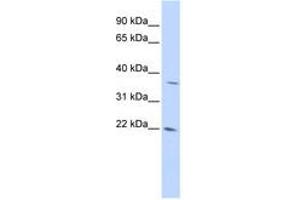 Image no. 1 for anti-DNA-Damage-Inducible Transcript 4-Like (DDIT4L) (AA 72-121) antibody (ABIN6741183) (DDIT4L antibody  (AA 72-121))